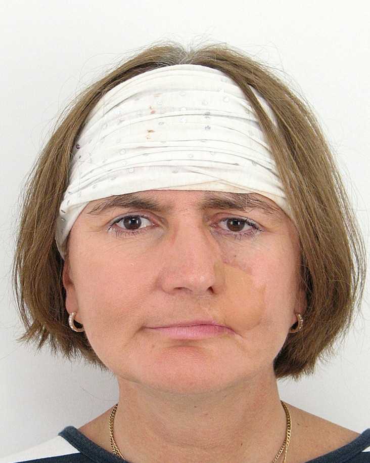 NOVANSKÁ Anna (62 rokov)